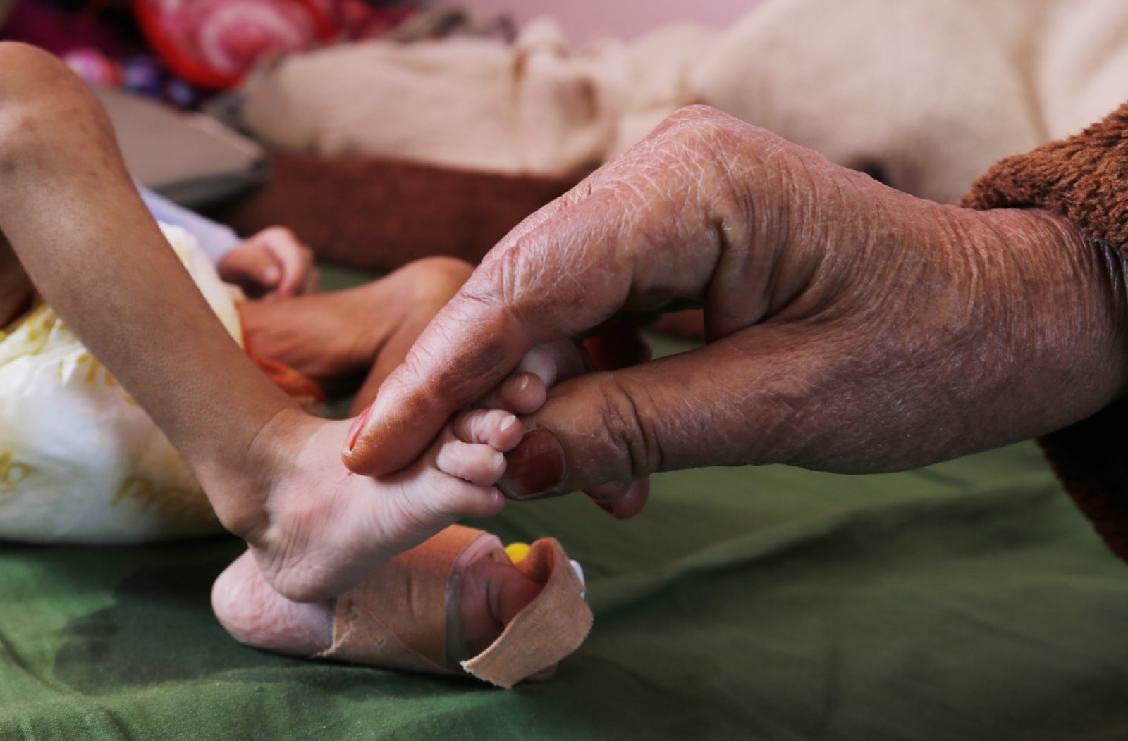 Babcia trzyma nóżkę swojego niedożywionego dziecka. Jemen. Fot. PAP/EPA/YAHYA ARHAB