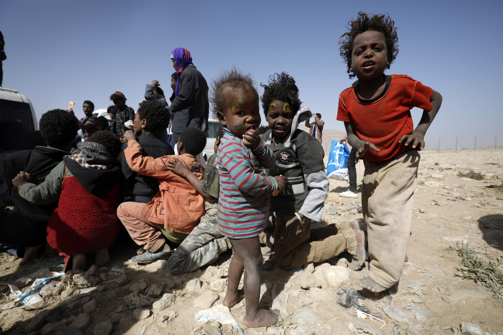 Dzieci - ofiary konfliktu w Jemenie EPA/YAHYA ARHAB 
