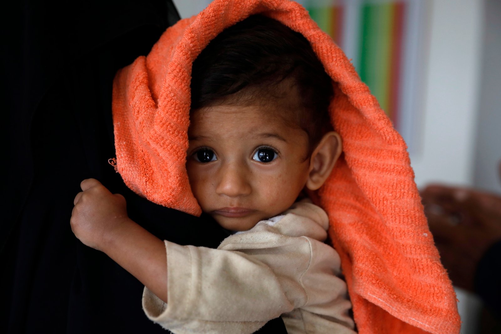 Jemen. Niedożywione dzieci EPA/YAHYA ARHAB 

