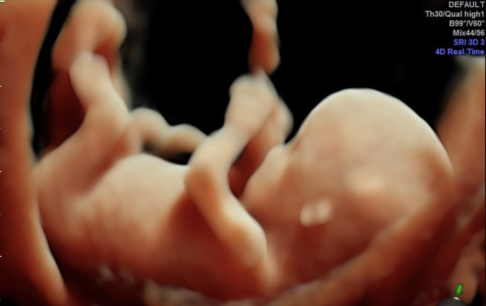 Portoryko: bezprecedensowe decyzje dla ochrony nienarodzonych dzieci 