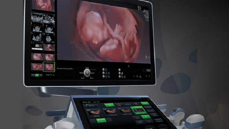 Michał Jurkiewicz: w Polsce są efekty troski o ludzkie życie