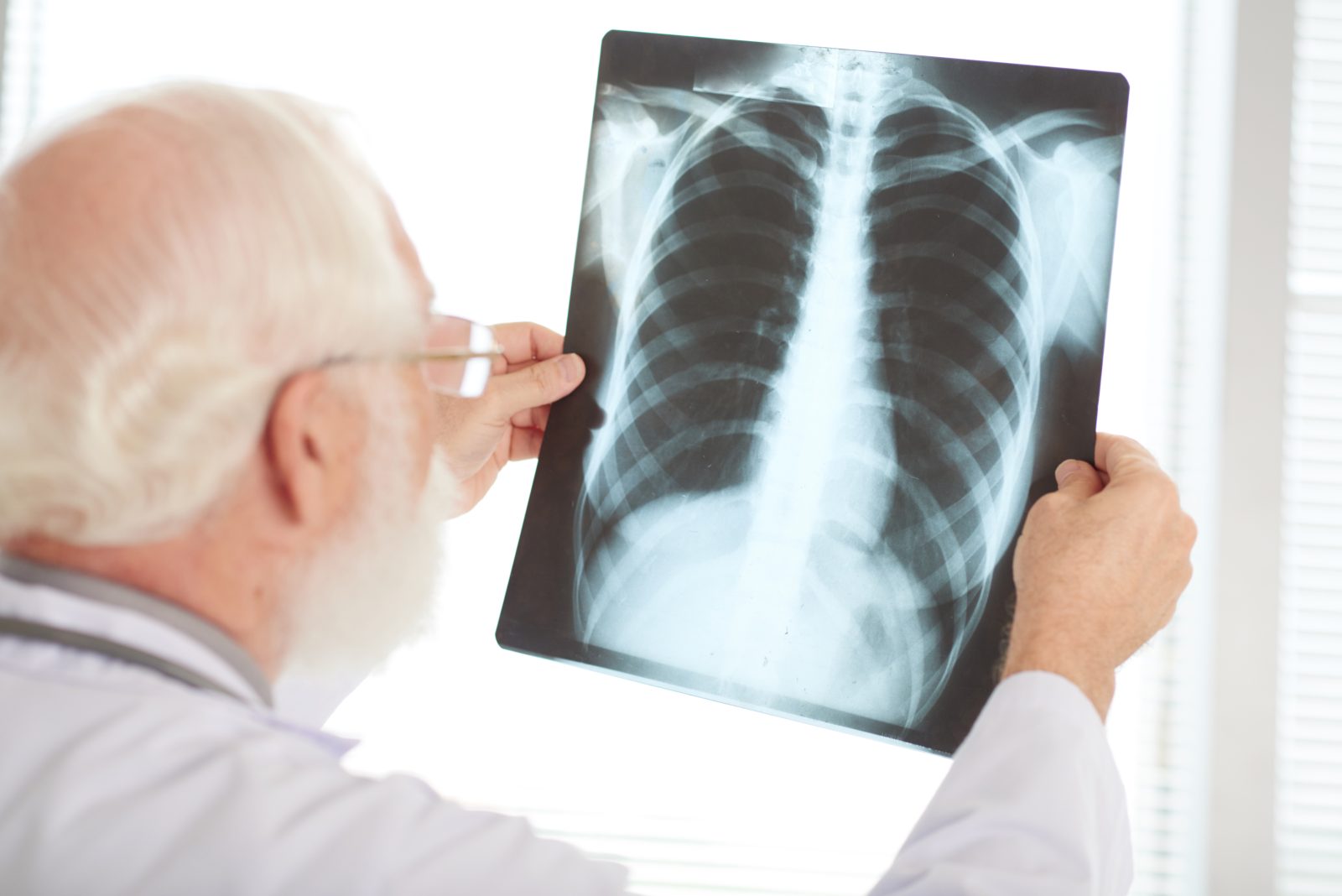 Eksperci: wprowadzenie badań przesiewowych to największy postęp w diagnostyce raka płuca od wielu lat